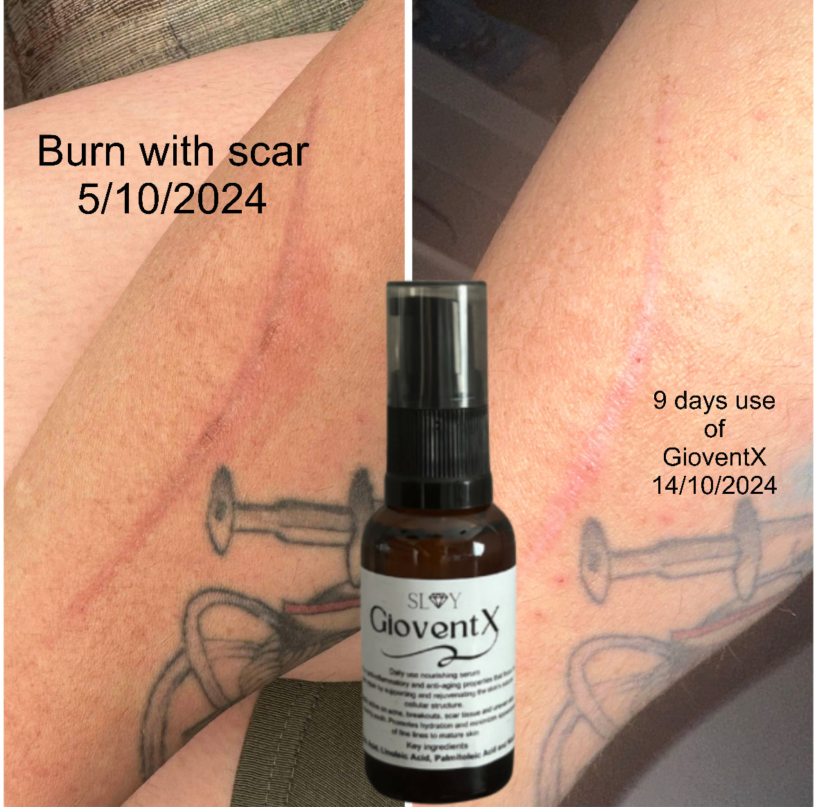 GioventX Serum