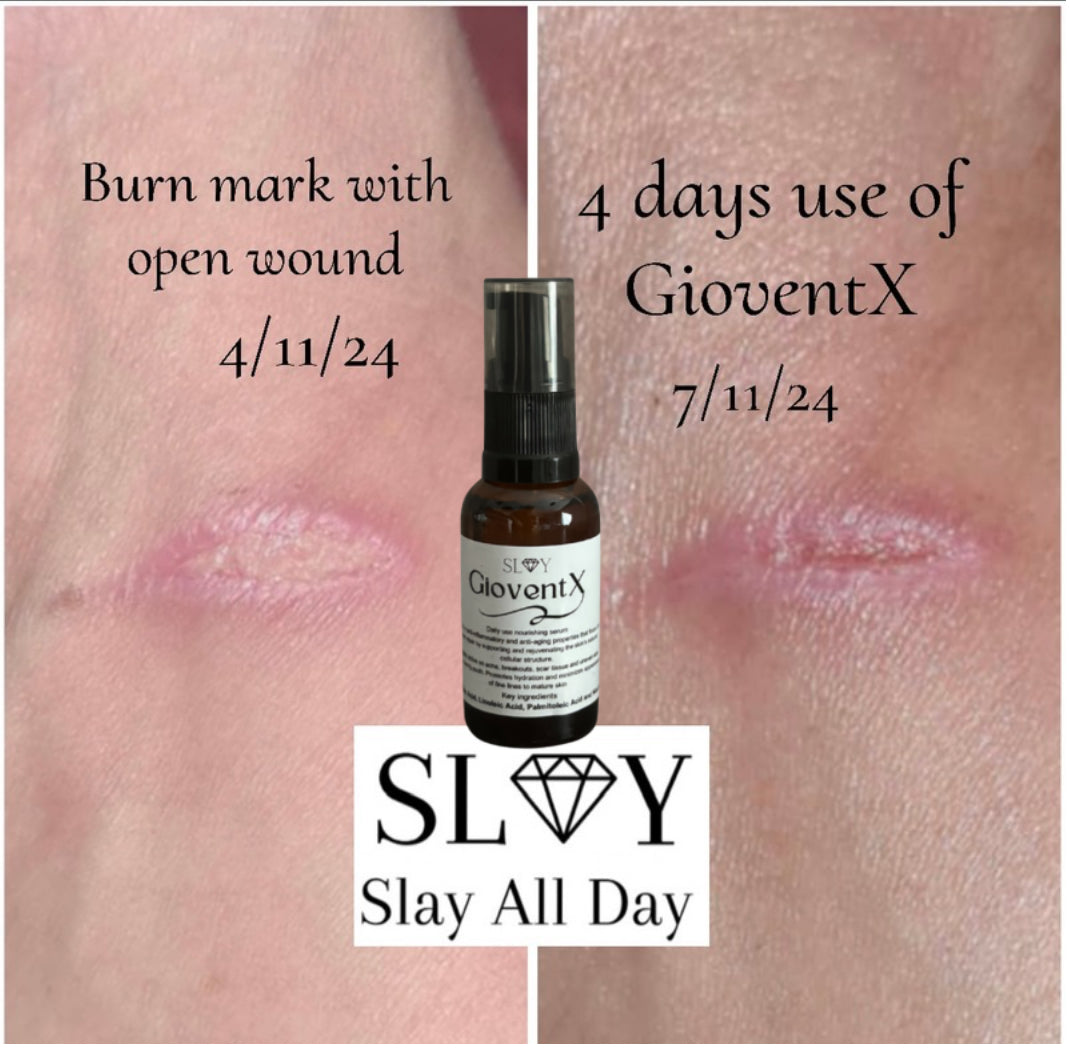 GioventX Serum