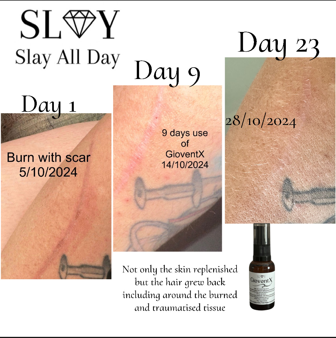 GioventX Serum