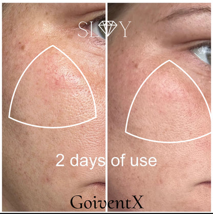 GioventX Serum